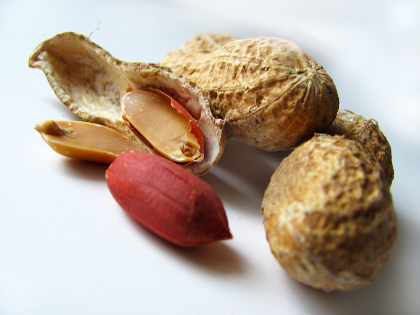 Peanut Allergy